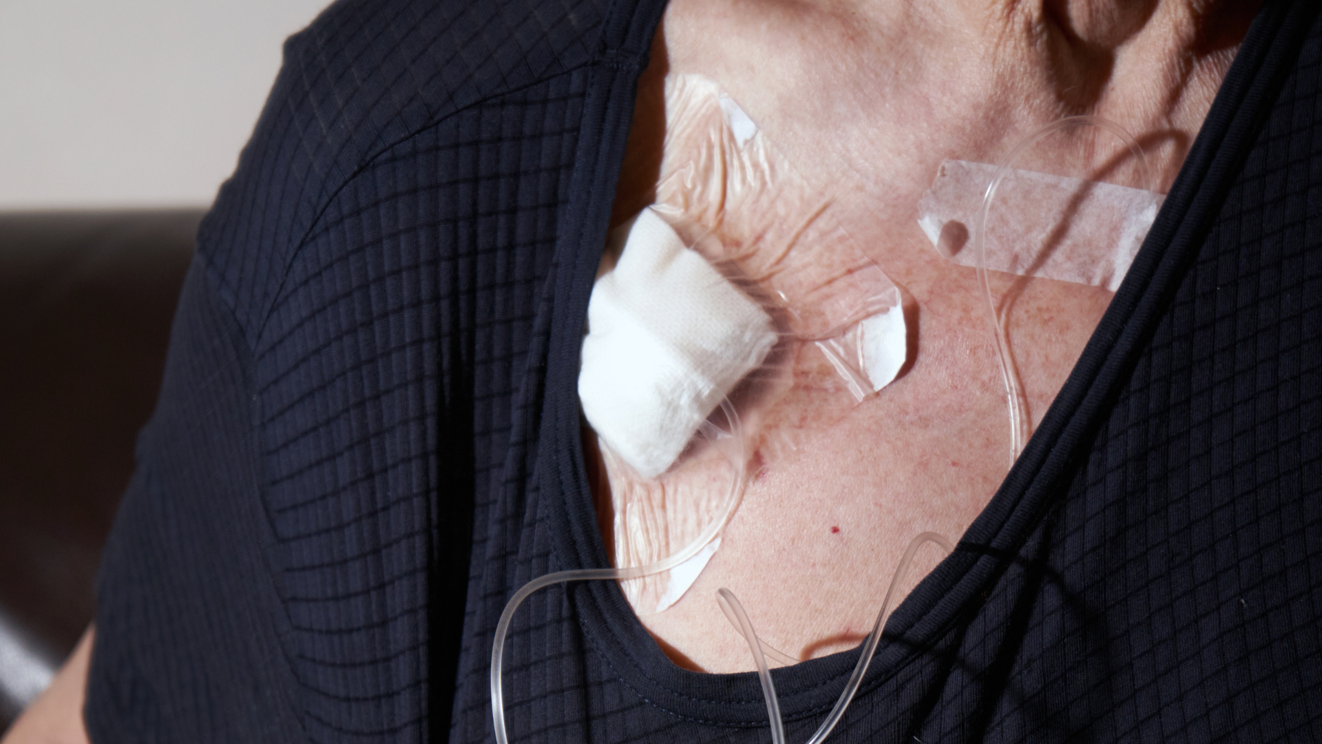 Chemo PowerPort Lawsuit: Device Failures and Serious Injuries